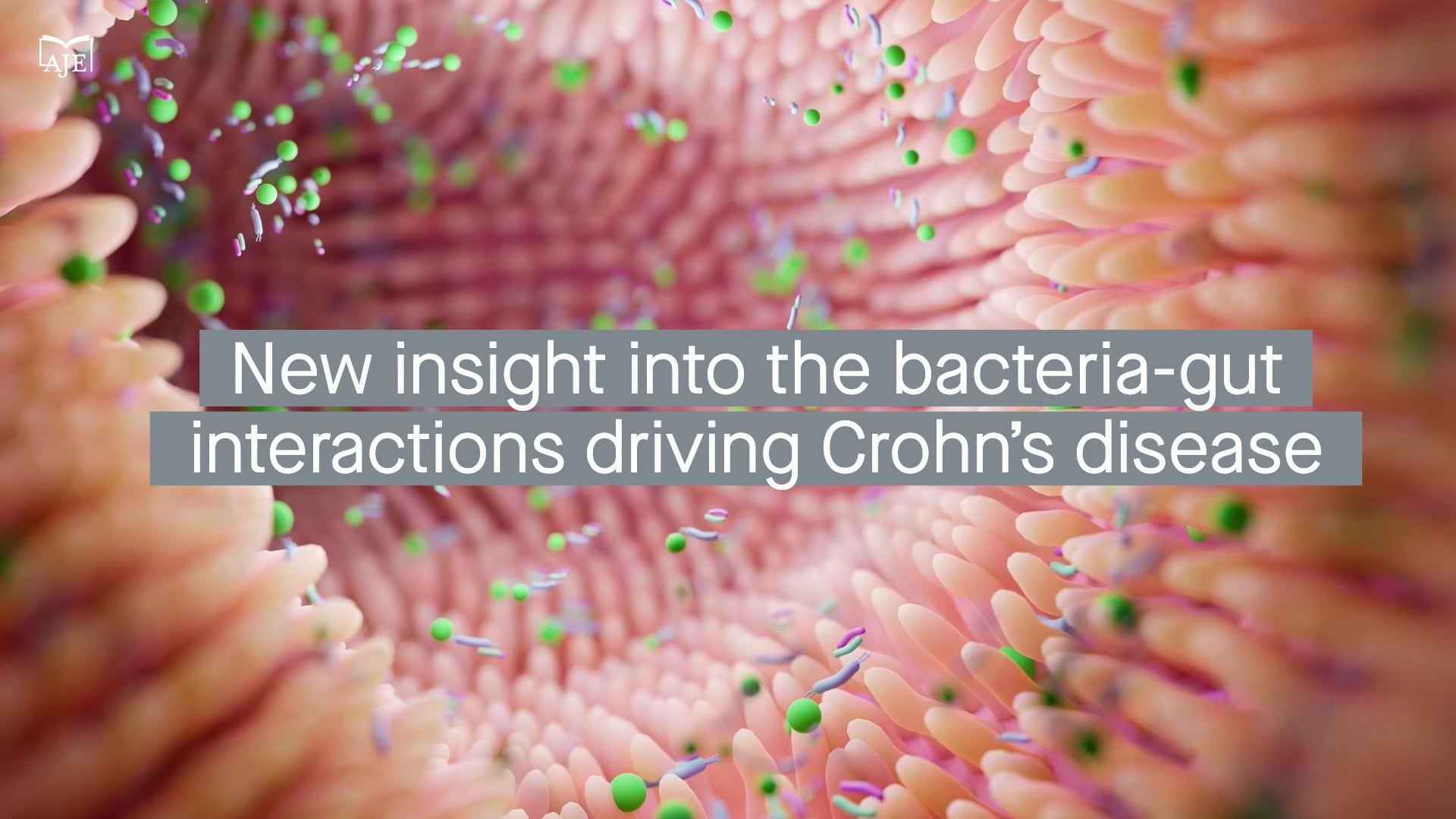Genetic profiling provides new insight into the bacteria-host cell interactions driving Crohn’s disease